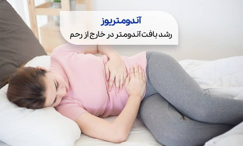 a/علائم اندومتریوز