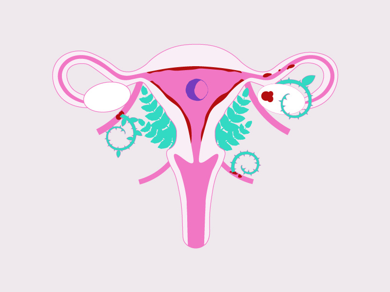 عکس رنگی رحم j/عکس رنگی رحم