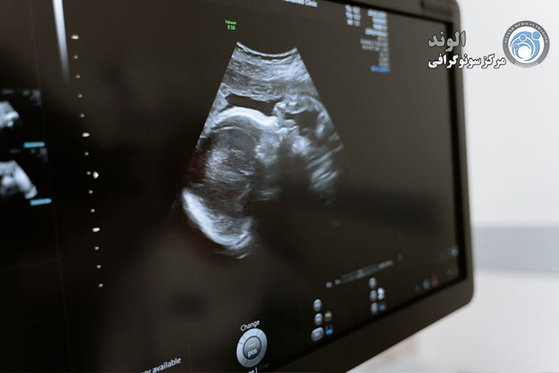 sonography/سونوگرافی حاملگی